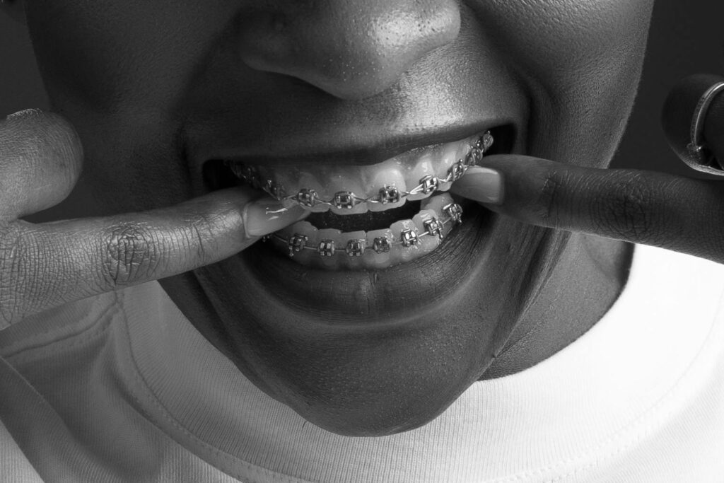 Tipos de ortodoncia: ¿qué aparato dental necesitas? PORTADA TIPOS DE ORTODONCIA EVODENTAL