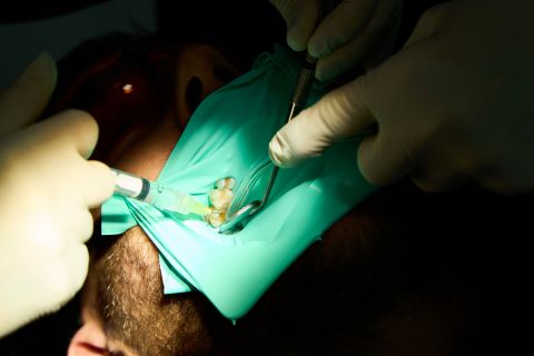 ENDODONCIAS EVODENTAL