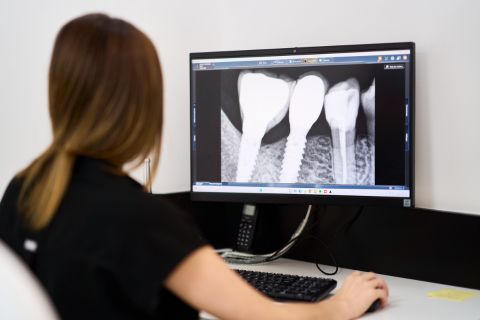 IMPLANTOLOGÍA EVODENTAL