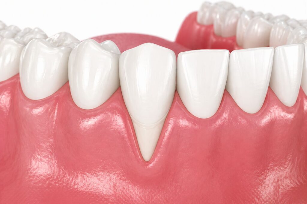 EVODENTAL ESTETICA DE ENCIAS